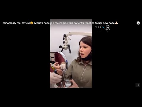 Rhinoplasty real review😊 Maria&#039;s nose job reveal| See this patient&#039;s reaction to her new nose👃🏻