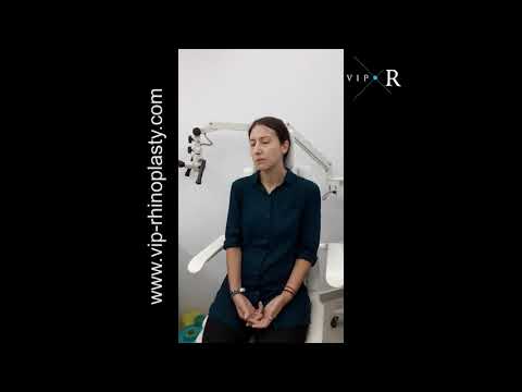 👃🏻 Rhinoplasty: Is nose job painful? Will my nose be swollen?Piezo surg with Dr.Mireas Case WP-01348